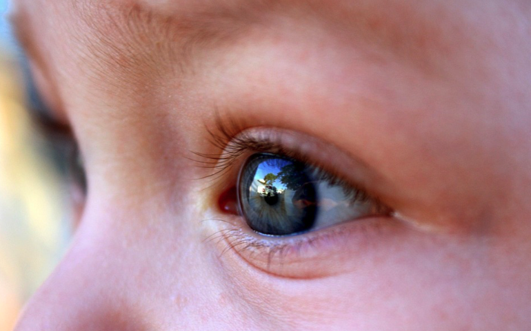 Child eye exam