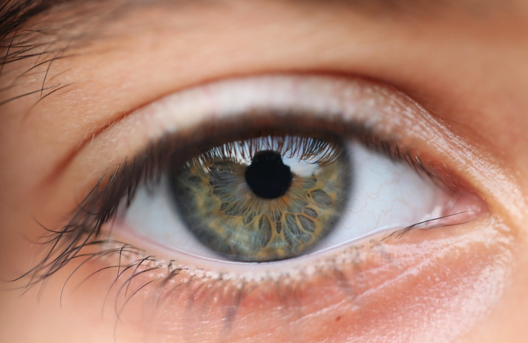 Illustration of glaucoma